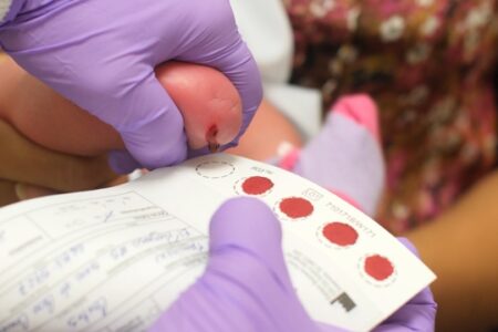 Tamizaje Metabólico Neonatal