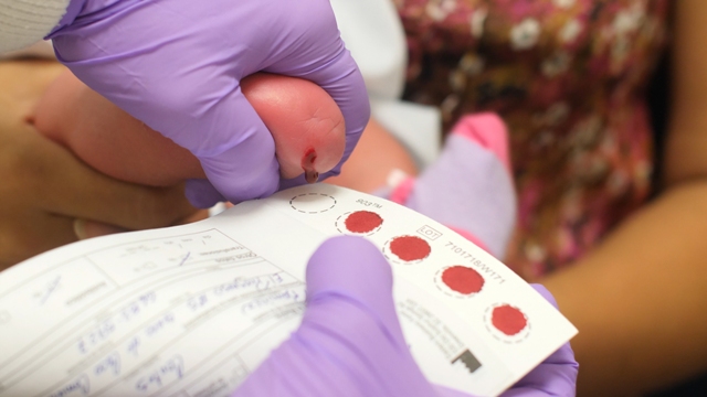 Tamizaje Metabólico Neonatal